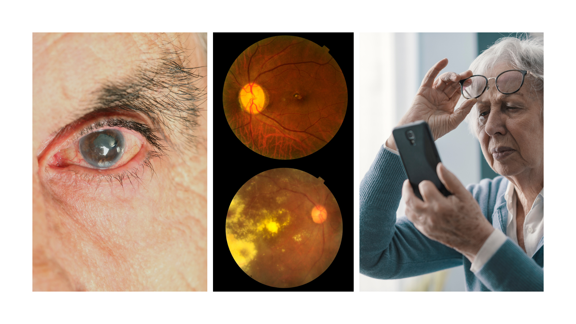 Man concerned about prostate health